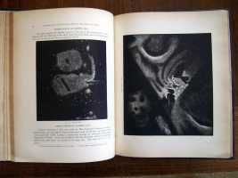 Temple and Lassell Observations